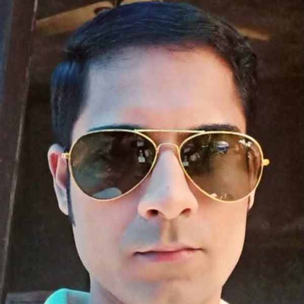 Same patient after hair transplant, receding hairline