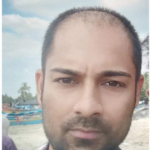 CHT patient before treatment, receding hairline